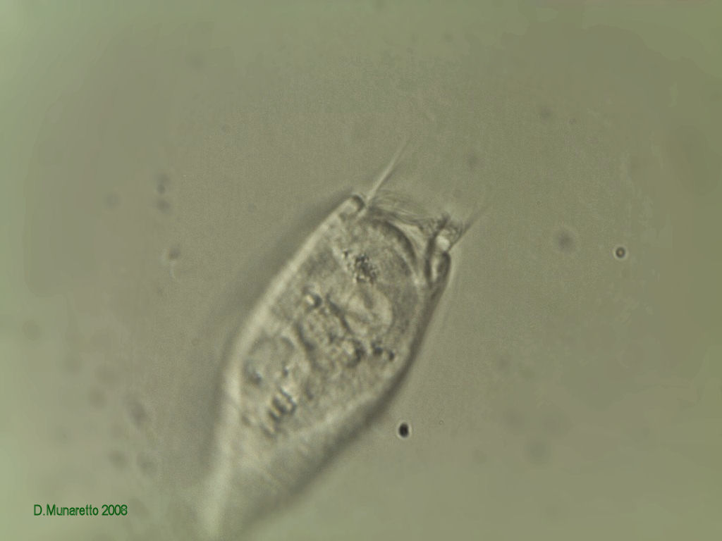 Vorticella in varie fasi di apertura